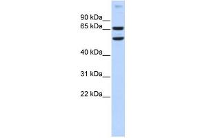 WB Suggested Anti-RELB Antibody Titration:  0. (RELB Antikörper  (N-Term))