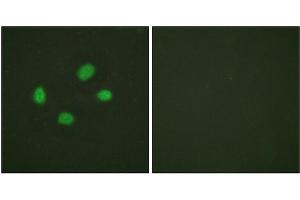 Immunofluorescence staining of methanol-fixed HeLa cells using Chk2 (Phospho-Thr383) Antibody. (CHEK2 Antikörper  (pThr383))