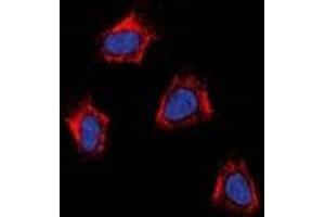 Immunofluorescent analysis of AT1 staining in K562 cells.