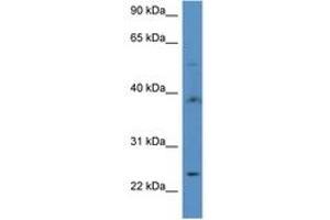 Image no. 1 for anti-Acyl-CoA Thioesterase 9 (Acot9) (AA 356-405) antibody (ABIN6746915) (ACOT9 Antikörper  (AA 356-405))