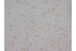 Immunohistochemistry on Paraffin Sections of Rat brain using AP23320PU-N CHRNA1 antibody. (CHRNA1 Antikörper  (N-Term, Subunit alpha))