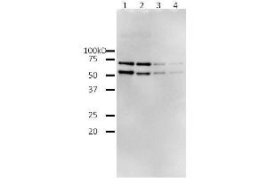 Western Blotting (WB) image for HIV-1 Reverse Transcriptase (HIV1RT) (Active) protein (ABIN2452197)