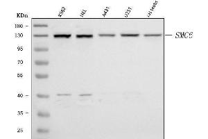 Western blot analysis of SMC6 using anti-SMC6 antibody (ABIN7601864). (SMC6 Antikörper  (AA 499-1018))
