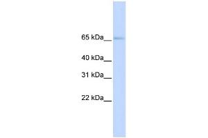 WB Suggested Anti-SLC22A6 Antibody Titration:  0. (SLC22A6 Antikörper  (N-Term))