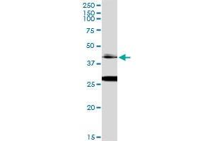 Immunoprecipitation of OTX1 transfected lysate using anti-OTX1 MaxPab rabbit polyclonal antibody and Protein A Magnetic Bead , and immunoblotted with OTX1 monoclonal antibody (M01), clone 1F2 . (OTX1 Antikörper  (AA 1-354))