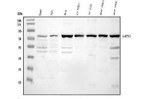 Western blot analysis of Calpain 2 using anti-Calpain 2 antibody (ABIN5518897).
