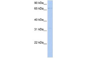 WB Suggested Anti-LSS Antibody Titration:  0. (LSS Antikörper  (Middle Region))