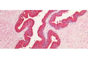 Immunohistochemistry (IHC) image for anti-Acid Phosphatase, Prostate (ACPP) (AA 217-386) antibody (ABIN7431248)