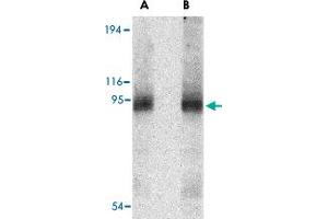 Western blot analysis of CD180 in human spleen tissue lysate with CD180 polyclonal antibody  at (A) 0.