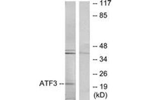 Western blot analysis of extracts from RAW264. (ATF3 Antikörper  (AA 131-180))
