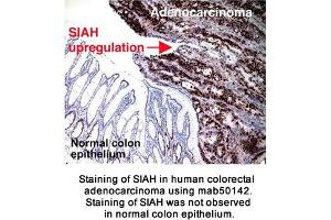 Image no. 2 for anti-Siah E3 Ubiquitin Protein Ligase 2 (SIAH2) (AA 1-100), (N-Term) antibody (ABIN363296) (SIAH2 Antikörper  (N-Term))