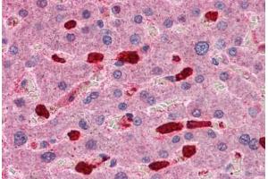 Human Liver: Formalin-Fixed, Paraffin-Embedded (FFPE) (ARHGAP18 Antikörper  (C-Term))