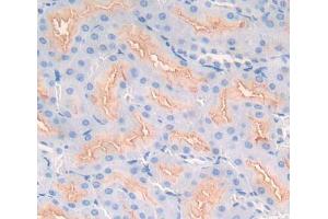 Used in DAB staining on fromalin fixed paraffin- embedded kidney tissue (SMPD2 Antikörper  (AA 1-324))