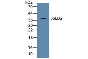 Figure. (DKK1 Antikörper  (AA 33-266))