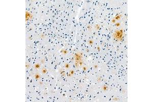 Immunohistochemistry analysis of paraffin embedded mouse Alzheimer',s brainusing Aβ40 (ABIN7073042) at dilution of 1:400 (Abeta 1-40 Antikörper)