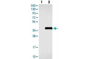 Western blot analysis of Lane 1: Negative control (vector only transfected HEK293T lysate), Lane 2: Over-expression Lysate (Co-expressed with a C-terminal myc-DDK tag (~3. (COLEC11 Antikörper)