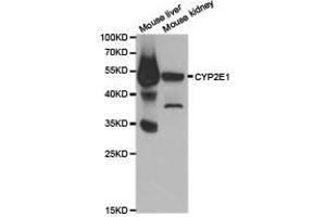 Western Blotting (WB) image for anti-Cytochrome P450, Family 2, Subfamily E, Polypeptide 1 (CYP2E1) antibody (ABIN1872172) (CYP2E1 Antikörper)