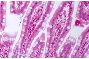 Anti-CTGF antibody IHC staining of human small intestine. (CTGF Antikörper)