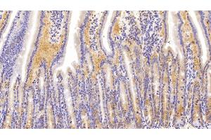 Detection of NME1 in Mouse Small intestine Tissue using Polyclonal Antibody to Non Metastatic Cells 1, Protein NM23A Expressed In (NME1) (NME1 Antikörper  (AA 6-147))
