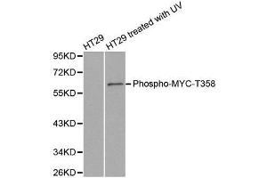 Western blot analysis of extracts from HT29 cells untreated or treated with UV, using phospho-MYC-T358 antibody. (c-MYC Antikörper  (pThr358))