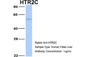 Western Blotting (WB) image for anti-5-Hydroxytryptamine (serotonin) Receptor 2C (HTR2C) (N-Term) antibody (ABIN2792274)