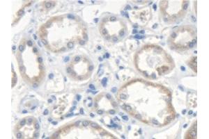 Immunohistochemistry (IHC) image for anti-Scavenger Receptor Class A, Member 5 (SCARA5) (AA 118-495) antibody (ABIN7441460)