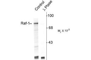 Image no. 1 for anti-V-Raf-1 Murine Leukemia Viral Oncogene Homolog 1 (RAF1) (pSer301) antibody (ABIN372711) (RAF1 Antikörper  (pSer301))