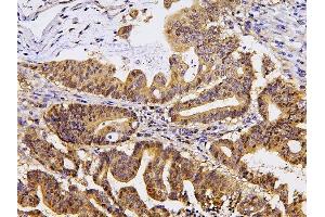 IHC analysis of PPA1 using anti-PPA1 antibody (ABIN6719527).