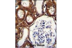GPX3 Antibody (Center) (ABIN650617 and ABIN2844787) immunohistochemistry analysis in formalin fixed and paraffin embedded human kidney tissue followed by peroxidase conjugation of the secondary antibody and DAB staining. (GPX3 Antikörper  (AA 93-123))