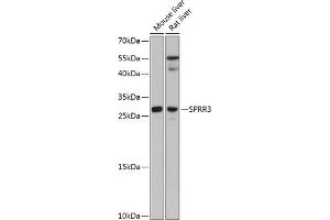 Western blot analysis of extracts of various cell lines, using SPRR3 antibody (ABIN6130714, ABIN6148386, ABIN6148387 and ABIN6215609) at 1:3000 dilution. (SPRR3 Antikörper  (AA 1-70))