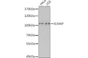 Western blot analysis of extracts of various cell lines, using SLMAP Rabbit pAb (ABIN7270147) at 1:3000 dilution. (SLMAP Antikörper  (AA 540-790))