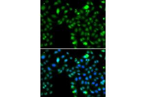 Immunofluorescence analysis of MCF7 cell using ING5 antibody. (ING5 Antikörper)