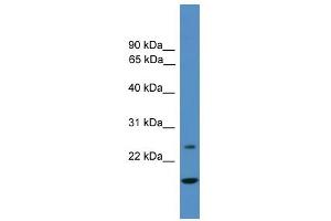 WB Suggested Anti-TFPI2 Antibody Titration: 0. (TFPI2 Antikörper  (N-Term))