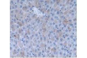 Immunohistochemistry (IHC) image for anti-Inhibin, beta A (INHBA) (AA 314-424) antibody (ABIN7426631)