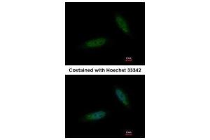 ICC/IF Image Immunofluorescence analysis of paraformaldehyde-fixed HeLa, using TBCK, antibody at 1:200 dilution.