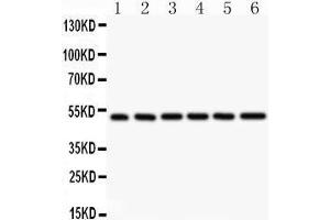 Western Blotting (WB) image for anti-Nuclear Factor of kappa Light Polypeptide Gene Enhancer in B-Cells 1 (NFKB1) (AA 1-360) antibody (ABIN3043587)