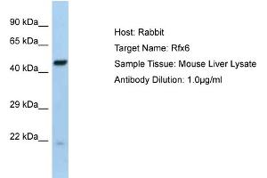 Host:  Rabbit  Target Name:  Rfx6  Sample Type:  Mouse Liver lysates  Antibody Dilution:  1. (RFX6 Antikörper  (Middle Region))