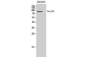 Western Blotting (WB) image for anti-Sec23 Homolog B (SEC23B) (Internal Region) antibody (ABIN3177351) (Sec23 Homolog B Antikörper  (Internal Region))