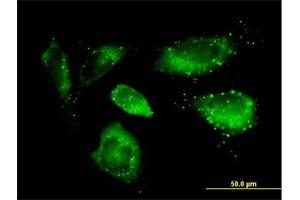 Immunofluorescence of purified MaxPab antibody to SQSTM1 on HeLa cell. (SQSTM1 Antikörper  (AA 1-440))