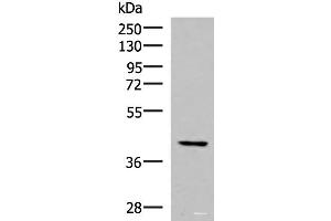 Western blot analysis of Hela cell lysate using IST1 Polyclonal Antibody at dilution of 1:1000 (IST1 Antikörper)