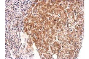 IHC-P Image Cyclophilin 40 antibody detects PPID protein at cytosol on human hepatoma by immunohistochemical analysis. (PPID Antikörper)