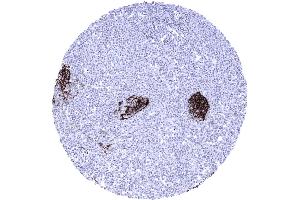 CD23 negative mantle cell lymphoma containing few germinal centre remnants that include CD23 positive dendritic cells (FCER2 Antikörper  (AA 48-321))