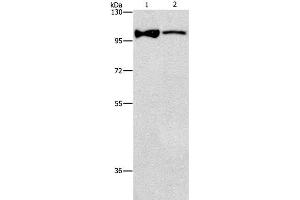Western Blot analysis of Lovo cell and Human fetal brain tissue using ADCY3 Polyclonal Antibody at dilution of 1:312. (ADCY3 Antikörper)
