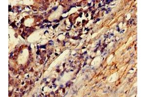 Immunohistochemistry of paraffin-embedded human smooth muscle tissue using ABIN7160538 at dilution of 1:100 (MYLK Antikörper  (AA 290-398))
