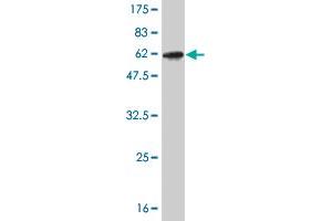 Western Blot detection against Immunogen (52. (CLIC1 Antikörper  (AA 1-241))