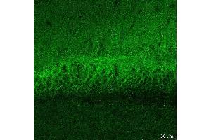 Indirect immunostaining PFA fixed hippocampus sections (dilution 1 : 500). (DLG3 Antikörper)