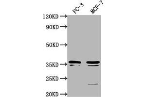 Western Blot Positive WB detected in: PC-3 whole cell lysate, MCF-7 whole cell lysate All lanes: OR6C1 antibody at 1:1000 Secondary Goat polyclonal to rabbit IgG at 1/50000 dilution Predicted band size: 36 kDa Observed band size: 36 kDa (OR6C1 Antikörper  (AA 259-275))