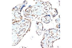 Immunohistochemistry of paraffin-embedded human placenta using PSM Rabbit mAb (ABIN7269597) at dilution of 1:100 (40x lens). (PSMA2 Antikörper)