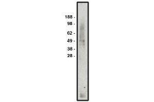 Western blot analysis using MCT3 antibody  used at 1:50k dilution. (MCT3 Antikörper)
