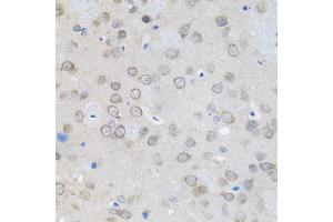 Immunohistochemistry of paraffin-embedded rat brain using UBE2A antibody (ABIN6132760, ABIN6149782, ABIN6149784 and ABIN6223686) (40x lens). (UBE2A Antikörper  (AA 1-152))